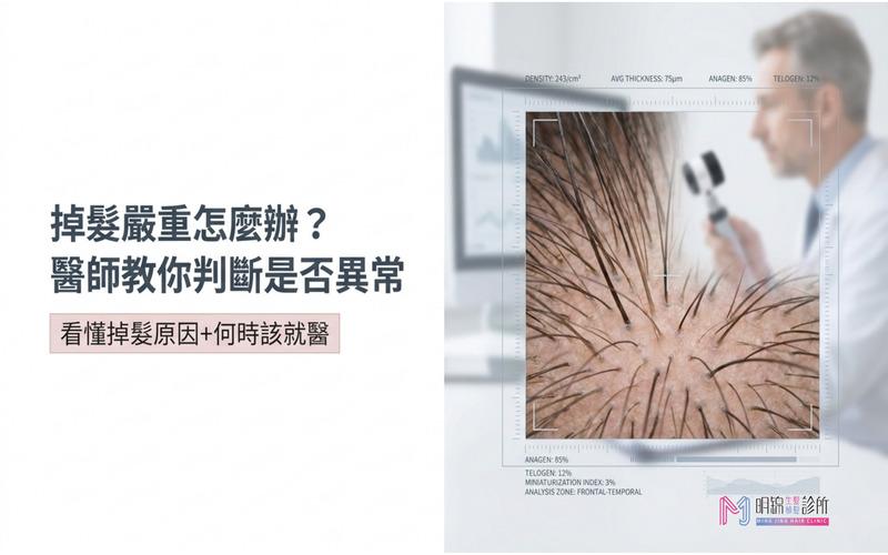 掉髮嚴重怎麼辦？一篇看懂頭髮一直掉的原因與該吃什麼才對！