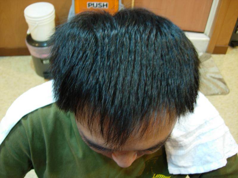 自然生髮/MH1015398-林先生