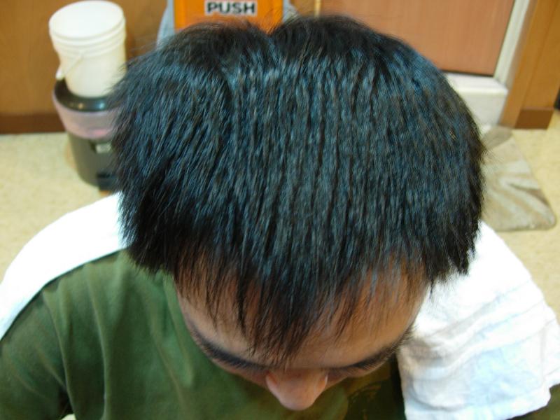 自然生髮/MH1018843-李先生